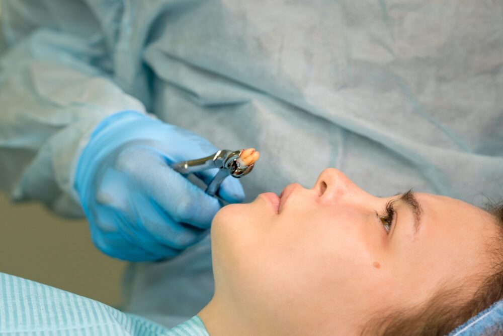 Wisdom Teeth Removal Elk City