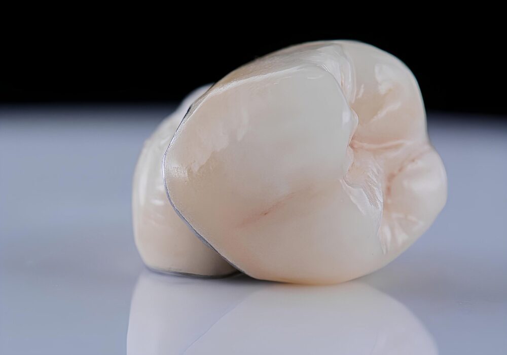 Dental Crowns Elk City