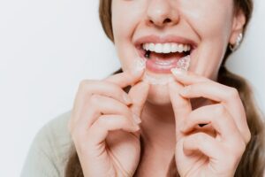 Clear Aligners Elk City