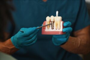 dental implants elk city